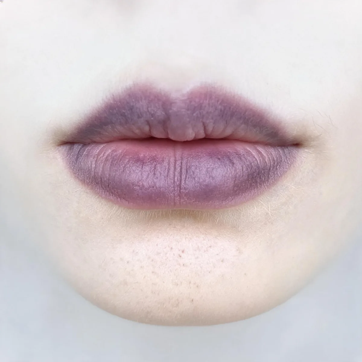 Lips and chin only showing dusky purple discolouration of the lips, no face above the mouth.